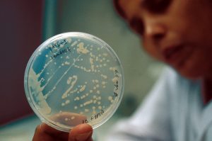 Muestra de bacterias dentro de la placa de Petri para estudio de biotecnología.